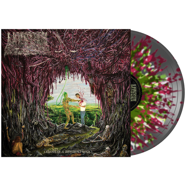 Undeath - Lesions of A Different Kind on Vinyl